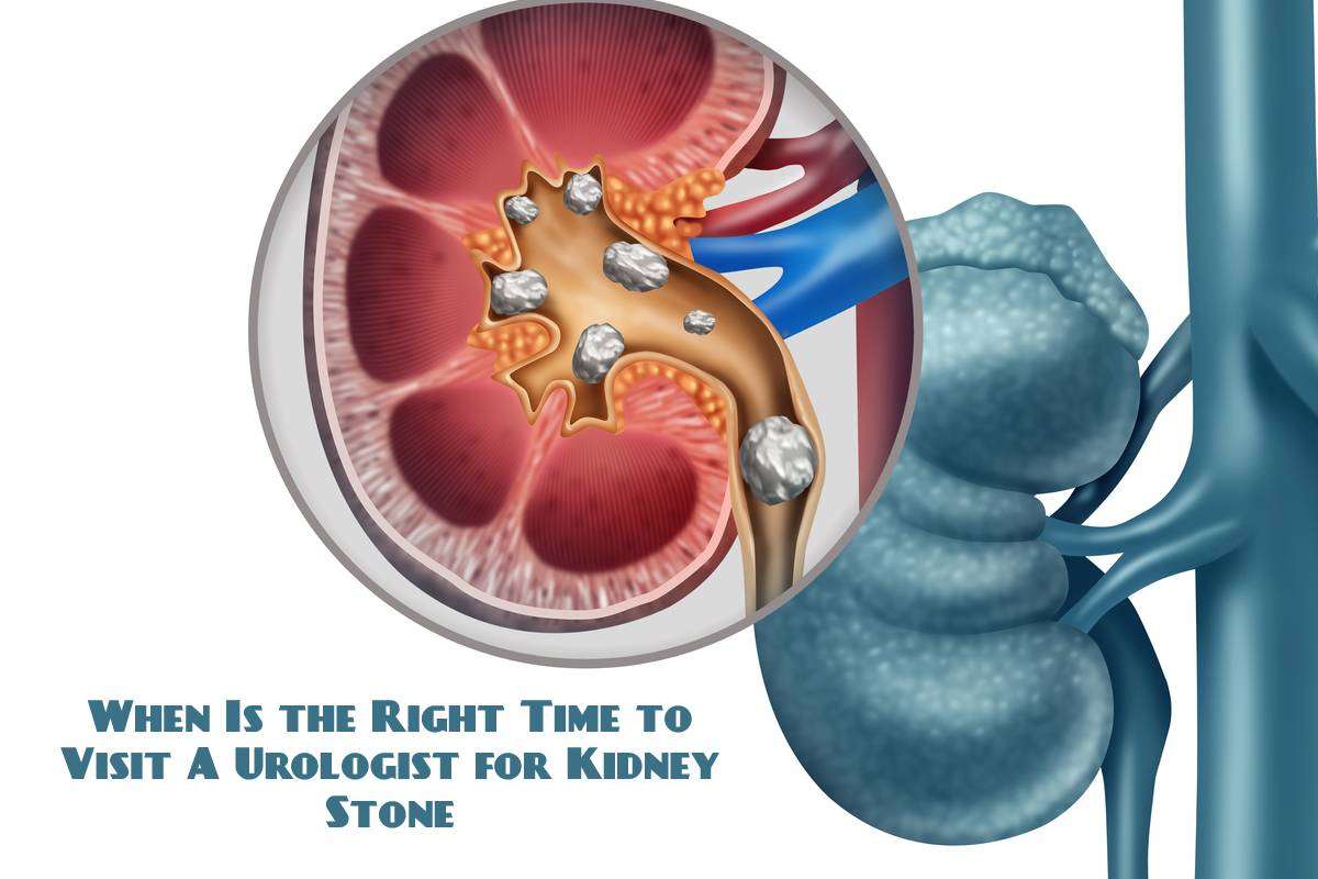 When Is the Right Time to Visit A Urologist for Kidney ...