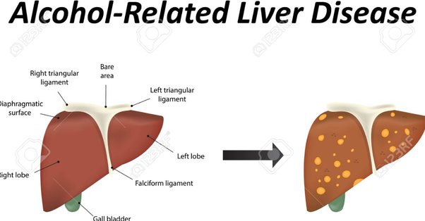 Why does alcohol directly affect the liver?