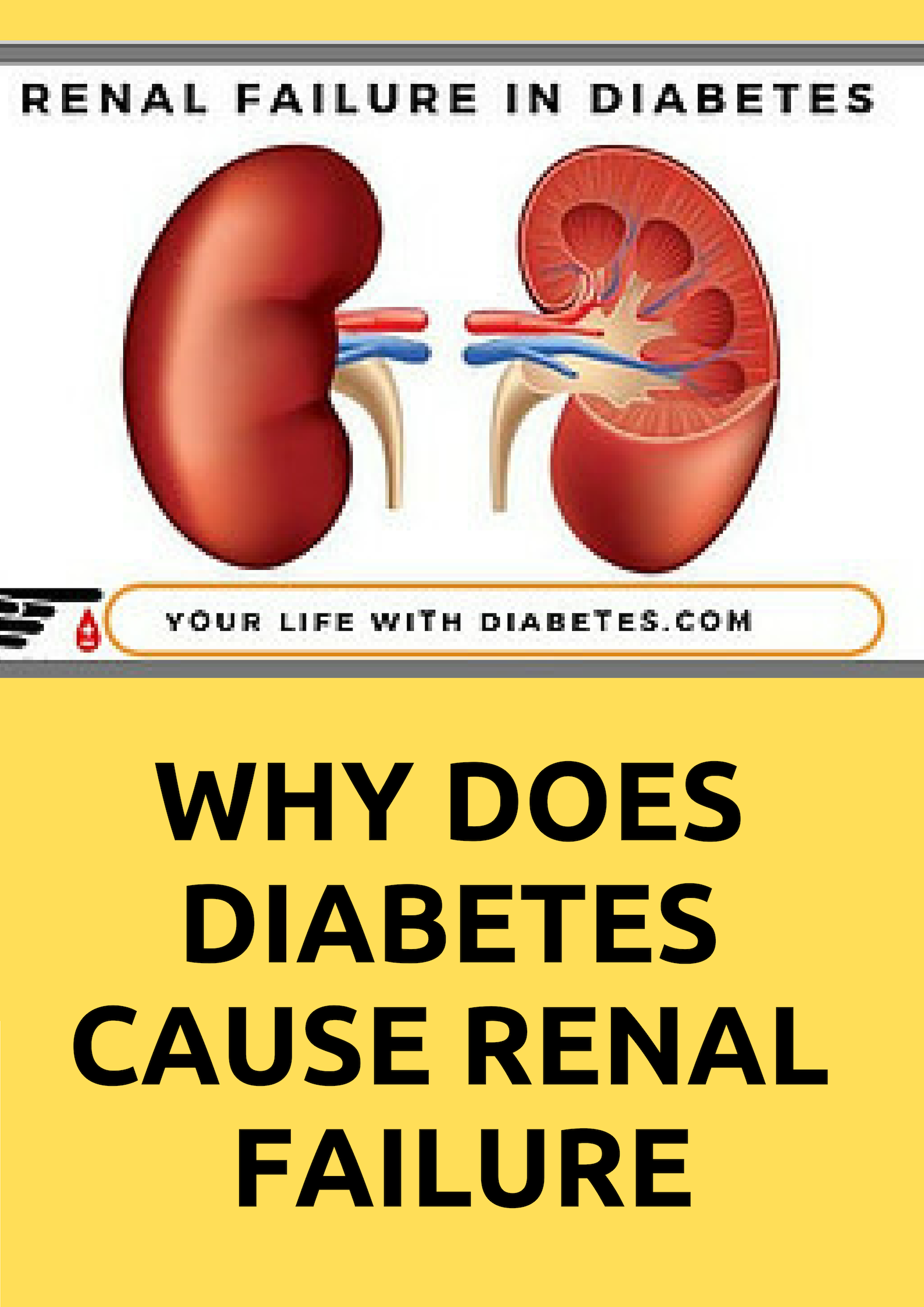 Why Does Diabetes Cause Renal Failure