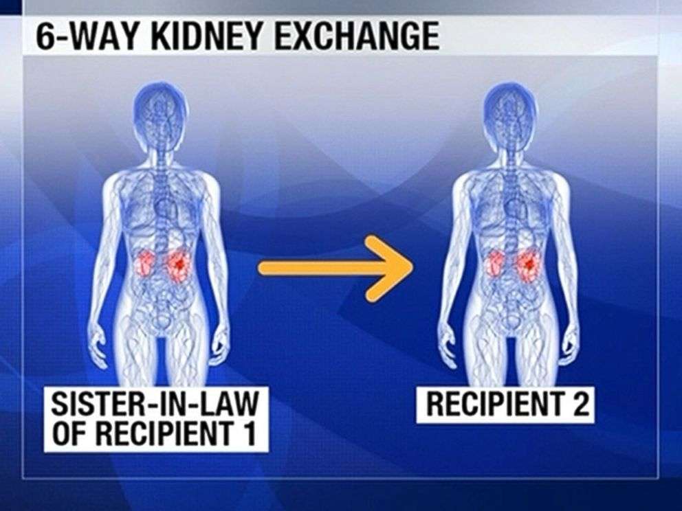 Woman Donates Kidney to Stranger, Starts Kidney Transplant Chain
