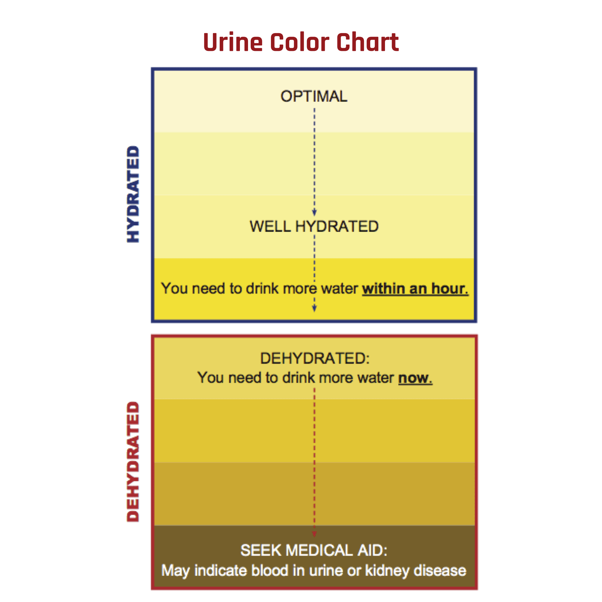 Woman Urine Color Kidney Failure