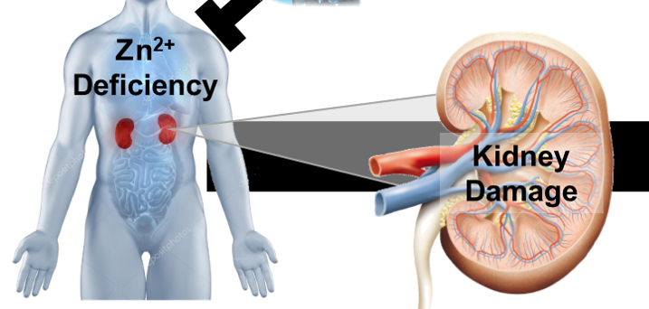 Zinc Deficiency Promotes Kidney Damage.  Clintoria Williams